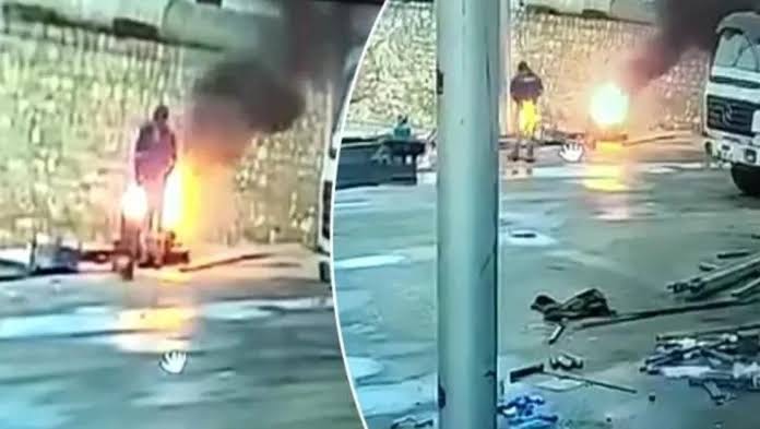 Isınmaya Çalışırken Pantolonu Tutuştu