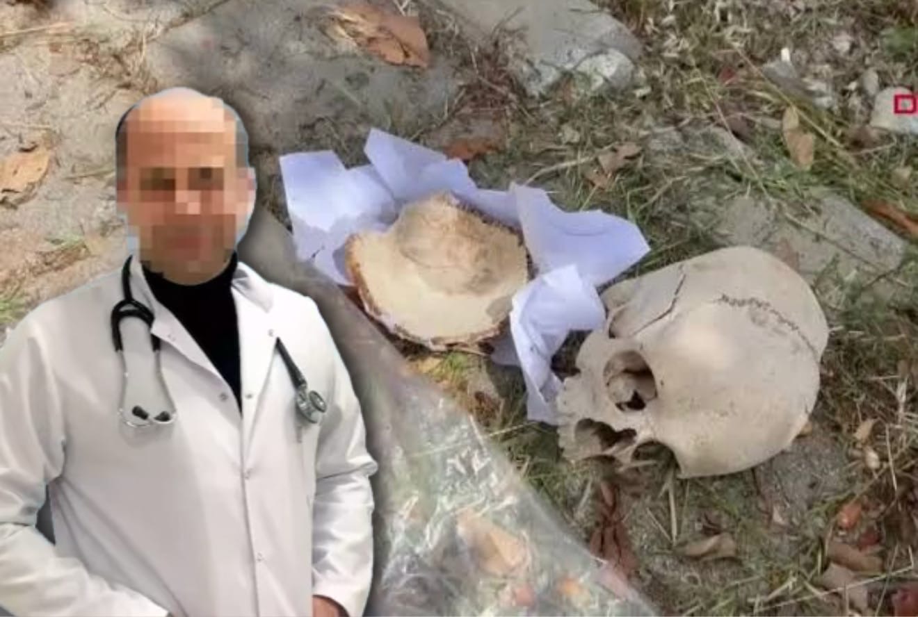 Çöplükteki Kafatasının Sırrı Çözüldü