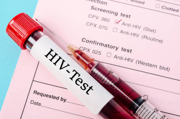 Adana’da Bir İlk: Seyhan Belediyesinden Ücretsiz ve Gizli Test Merkezi